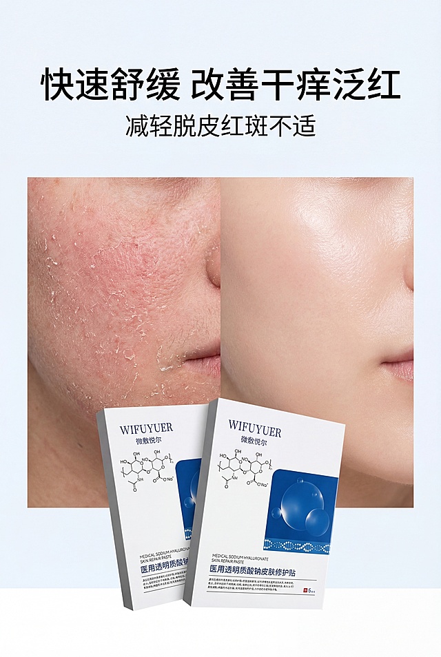 严格还原上传产品参考图，精准复刻包装设计、产品配色、LOGO位置及比例、文字内容及字体、图案元素及细节，无任何偏差，色彩无失真。产品与画面中其他物体（道具、手持模型、场景元素等）的比例遵循真实物理空间逻辑，视觉协调，比例还原1:1，杜绝比例失衡、视觉突兀。画面比例为 2:3 竖版，极简医疗风。主标题“快速舒缓 改善干痒泛红”位于画面上五分之一居中；副标题“减轻脱皮红斑不适”在主标题下方居中；画面为左右肌肤状态对比图，微敷悦尔产品置于底部中央；上下排版，留白占比百分之三十；柔和对比色调，自然光，无夸张磨皮。负面提示词：效果过度夸张，假白，磨皮过重，色彩失真，对比刺眼，产品变形，比例失调，模糊，杂乱背景，多余装饰，字体丑陋，排版混乱，土气