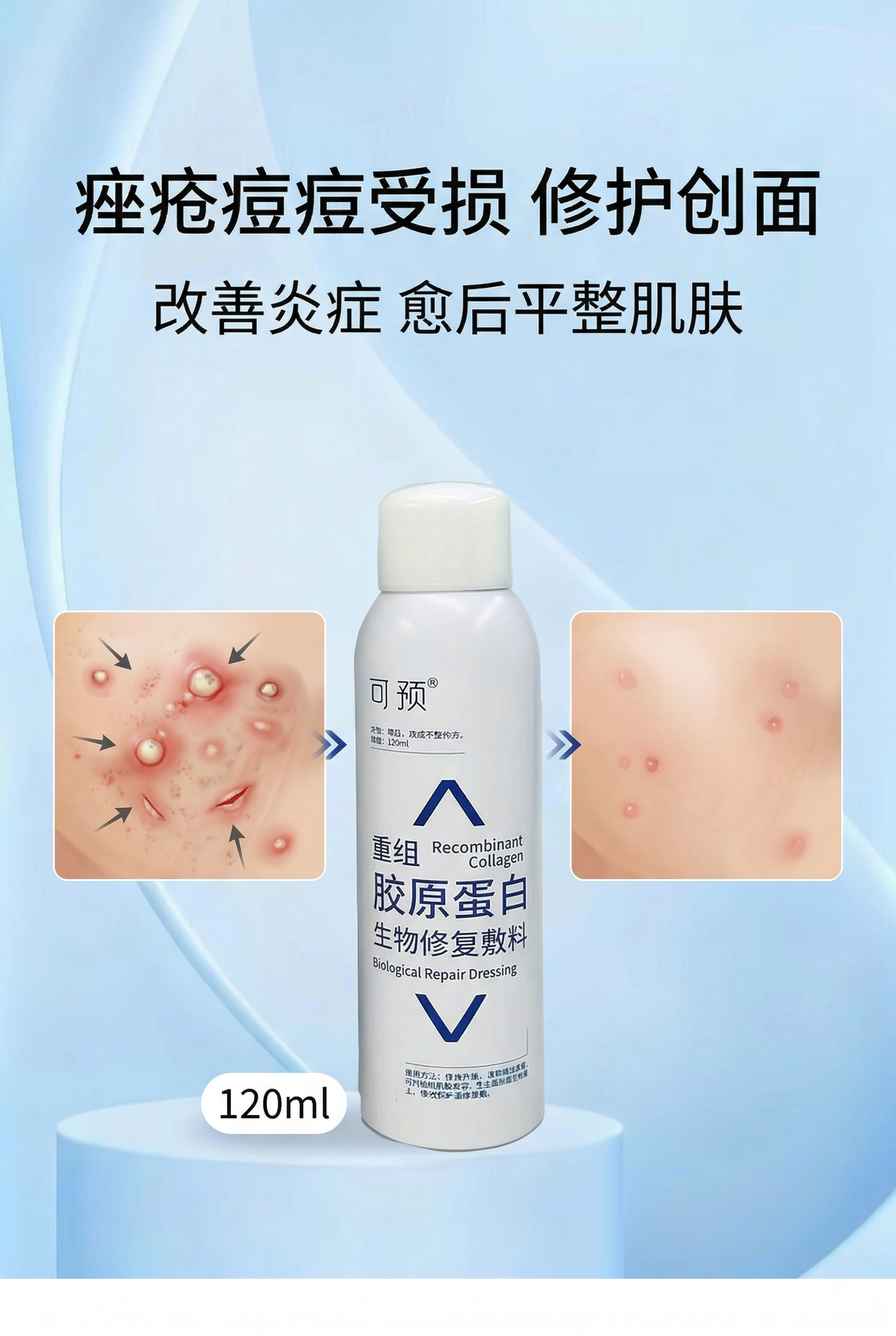 严格还原上传的可预重组胶原蛋白生物修复敷料P型产品参考图，精准… - 图片创意预览