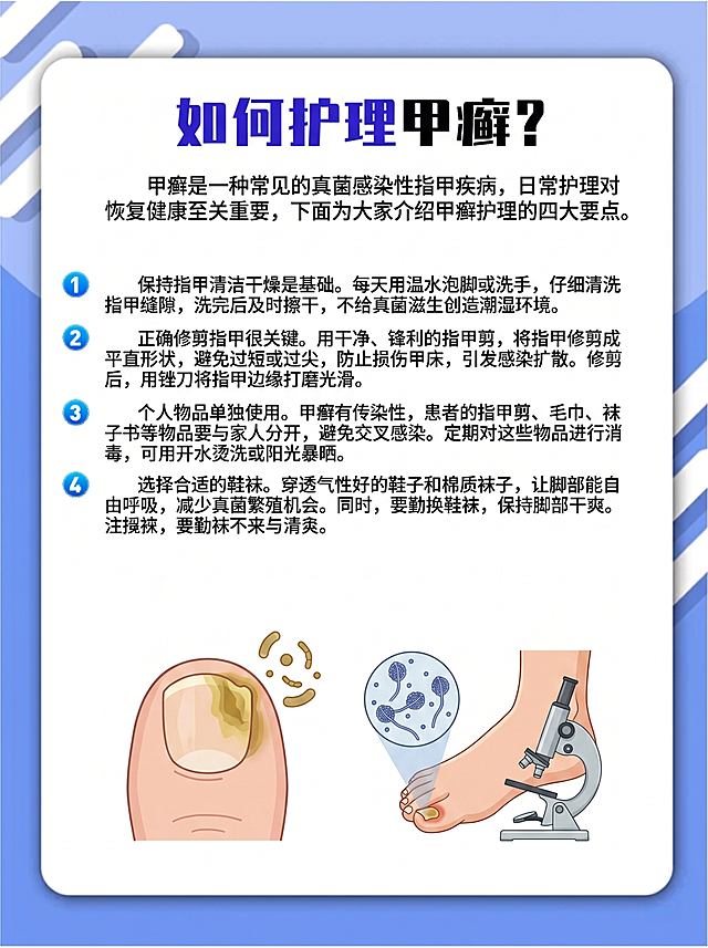 参考原图的医疗科普海报风格，替换内容为如何护理甲癣科普，标题是“如何护理甲癣？”，内容分段为：1.保持指甲清洁干燥是基础。每天用温水泡脚或洗手，仔细清洗指甲缝隙，洗完后及时擦干，不给真菌滋生创造潮湿环境。2.正确修剪指甲很关键。用干净、锋利的指甲剪，将指甲修剪成平直形状，避免过短或过尖，防止损伤甲床，引发感染扩散。修剪后，用锉刀将指甲边缘打磨光滑。3.个人物品单独使用。甲癣有传染性，患者的指甲剪、毛巾、袜子等物品要与家人分开，避免交叉感染。定期对这些物品进行消毒，可用开水烫洗或阳光暴晒。4.选择合适的鞋袜。穿透气性好的鞋子和棉质袜子，让脚部能自由呼吸，减少真菌繁殖机会。同时，要勤换鞋袜，保持脚部干爽。整体为蓝色渐变背景，白色圆角内容框，蓝色圆形数字序号，底部保留指甲皮肤病理示意图位置，医疗科普风格。