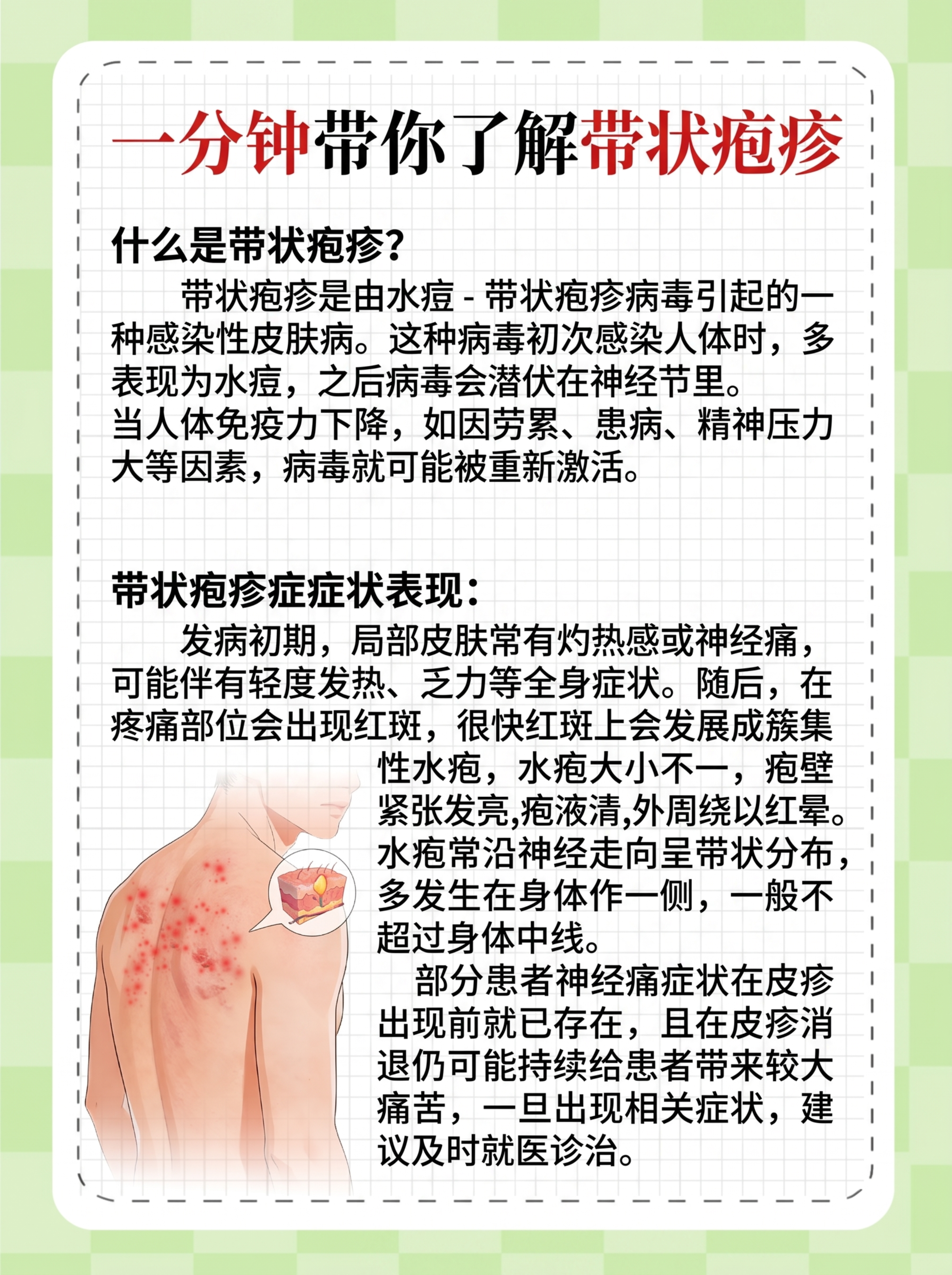 参考原图的医疗科普海报风格，替换内容为一分钟带你了解带状疱疹科… - 图片创意预览