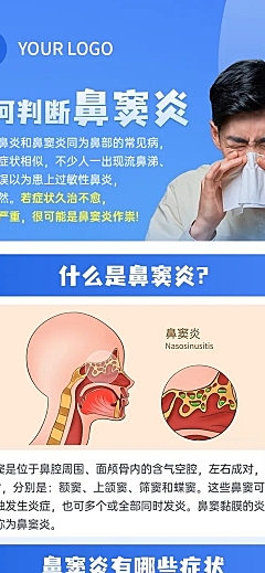 鼻窦炎健康知识科普分享蓝色现代感长图海报