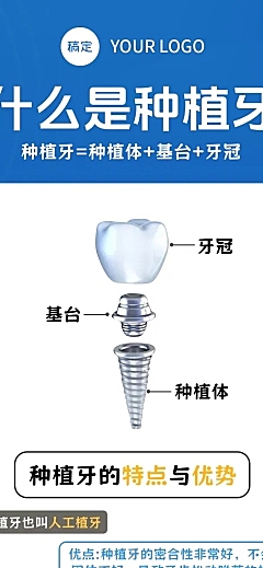 简约蓝色系医疗保健种植牙科普宣传长图海报