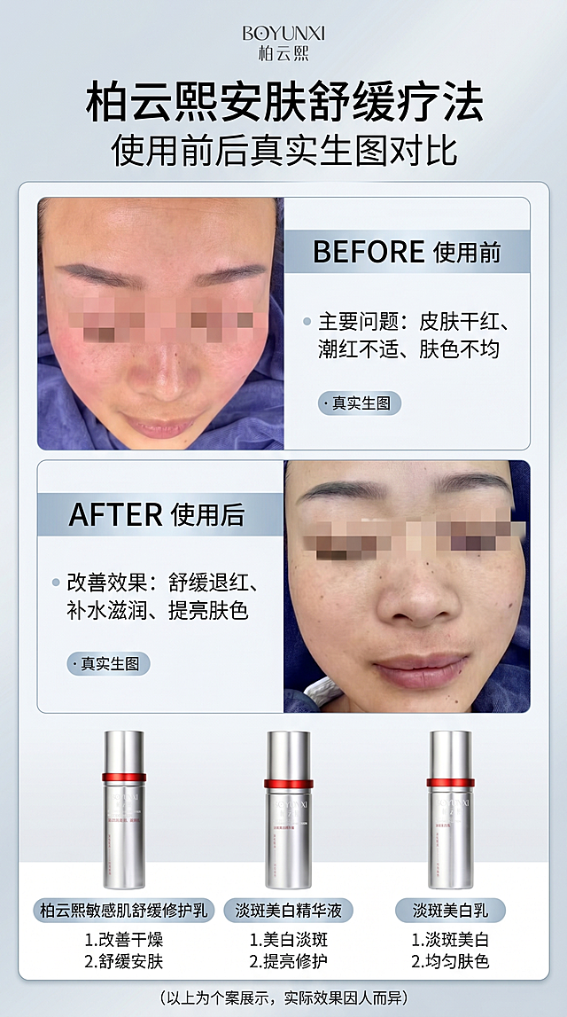 生成9:16竖版柏云熙安肤舒缓疗法使用前后对比图，轻医美设计风格，保留原图使用前后真实生图对比不美颜美化，放入柏云熙敏感肌舒缓修护乳、淡斑美白精华液、淡斑美白乳三款产品，展示产品信息和改善干燥、舒缓安肤、美白淡斑的功效，构图为上下/左右对比展示，专业简约的轻医美宣传风格