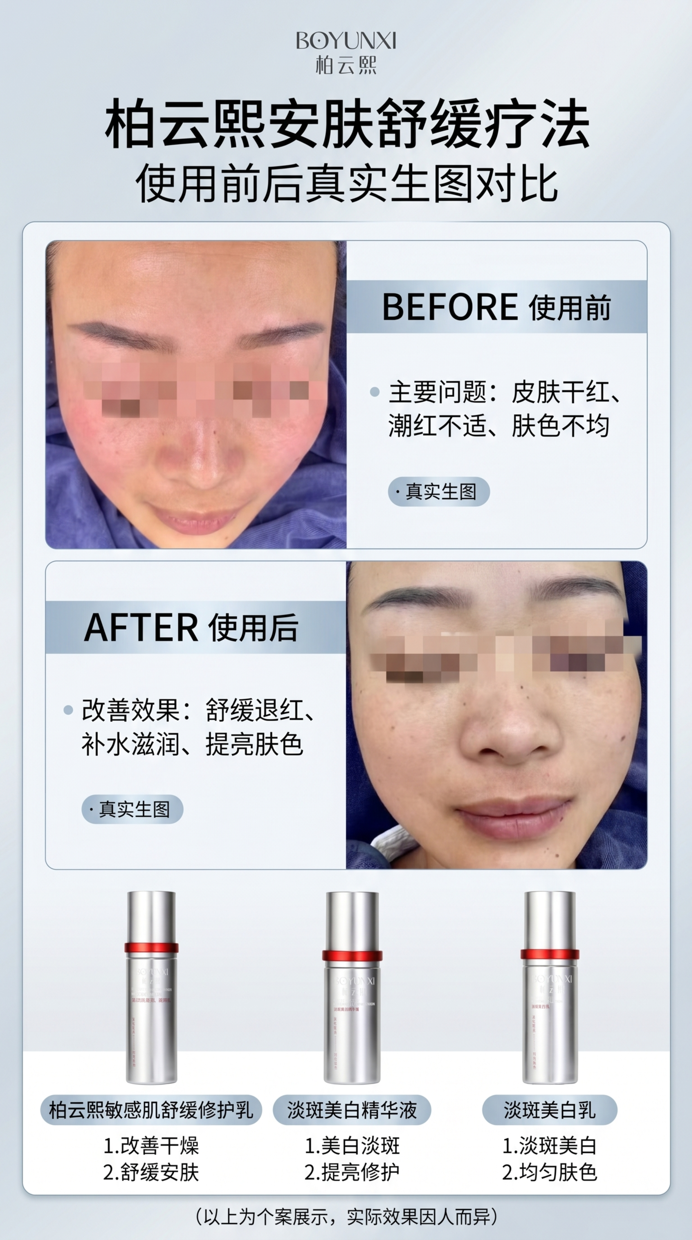 生成9:16竖版柏云熙安肤舒缓疗法使用前后对比图，轻医美设计风… - 图片创意预览
