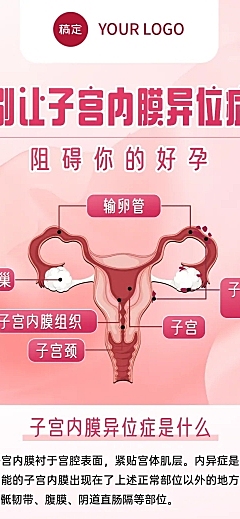 妇科疾病知识科普子宫内膜异位症知识分享长图海报