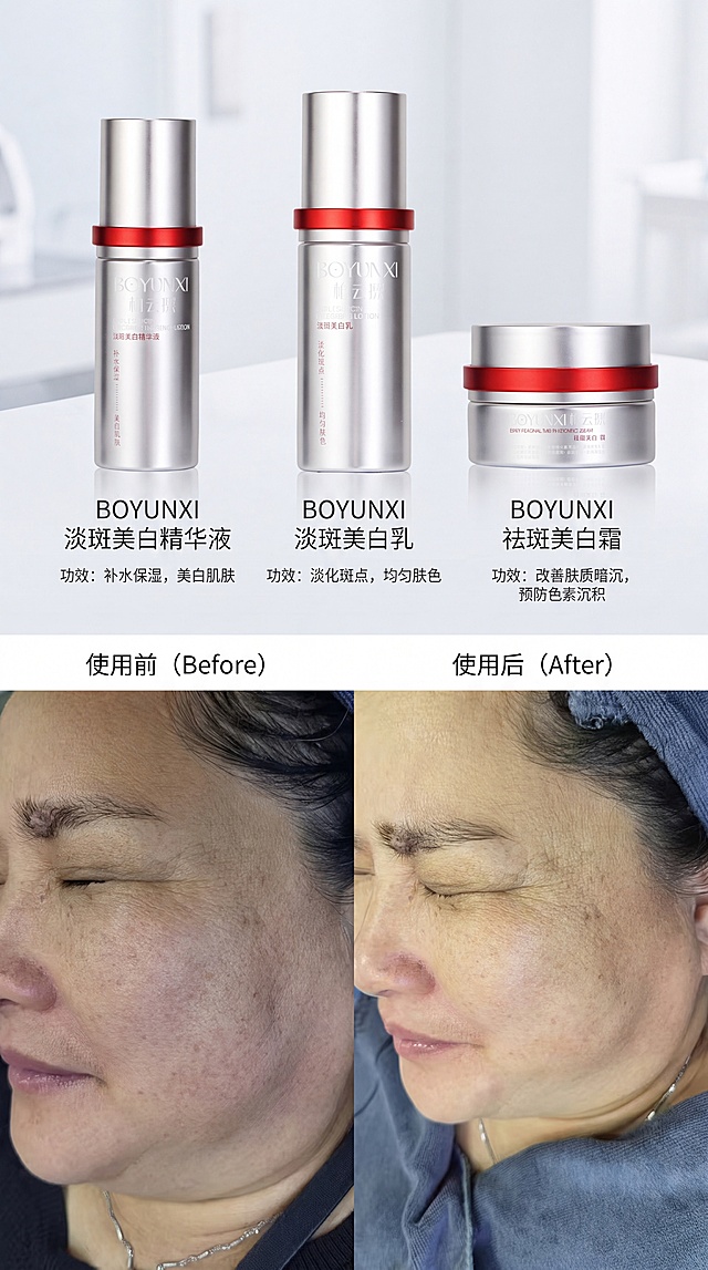 柏云熙断黑三宝使用前后对比图，保留原图中使用前后对比部分不变，保持原生态不美颜美化，上方添加三张柏云熙产品图：淡斑美白精华液、淡斑美白乳、祛斑美白霜，标注产品名称和功效，字迹高清清晰不乱码，设计风格为轻医美，比例9:16
