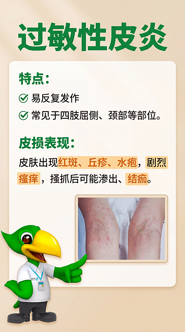 小红书第二页贴图，过敏性皮炎科普，基于图片[image1]重新设计，保留原内容：标题过敏性皮炎，特点：易反复发作，常见于四肢屈侧、颈部等部位，皮损表现：皮肤出现红斑、丘疹、水疱，剧烈瘙痒，搔抓后可能渗出、结痂，设计风格色彩搭配大气，符合药店店员科普传播场景要求，排版突出核心内容，适读性强，角落添加绿色啄木鸟吉祥物形象[image6]，保留形象特征，改编动作适配版面，整体为小红书竖版科普贴图