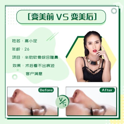 双十一美容美妆效果对比图方形海报