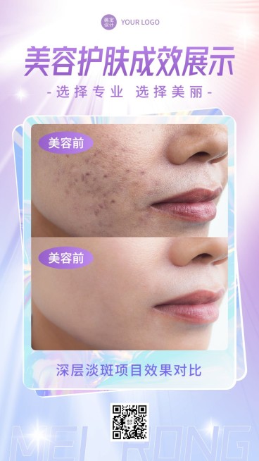 美业美容护肤效果展示前后对比图简约手机海报预览效果