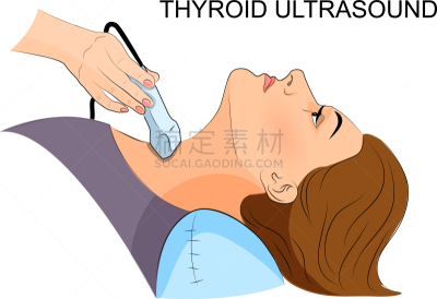 甲状腺,超声波,甲状腺机能减退,健康保健,医学扫描,肿瘤学,图像,稳态,女人