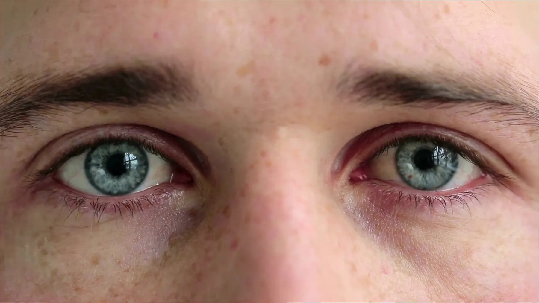 雀斑 雀斑图片 雀斑素材下载 稿定素材