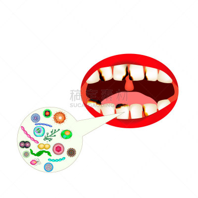 人的嘴,矢量,牙齿,绘画插图,分离着色,口腔,健康保健,干净,图表