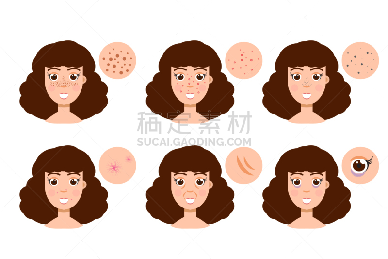 女人,问题,粉刺,动物皮,分离着色,人,多样,皮肤病学,脓肿