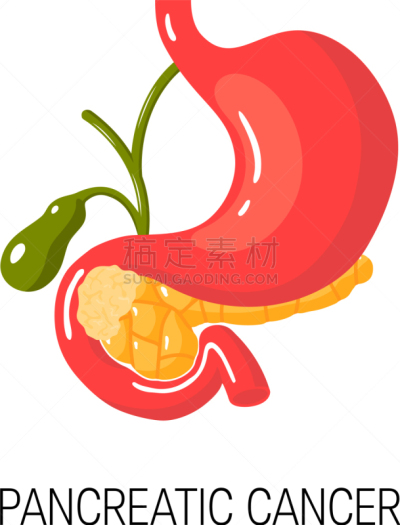 概念,胰腺癌,白色,分离着色,健康保健,人,药,生病