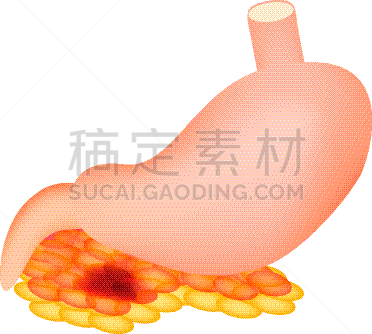 胃,白色,症状,锐角,健康保健,人,生病