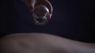 人体背部拔罐疗法