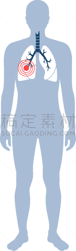 分离着色,人类肺脏,生物学,呼吸运动,健康保健,人,图表,概念,生病