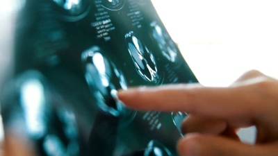 检查磁共振图像(MRI)