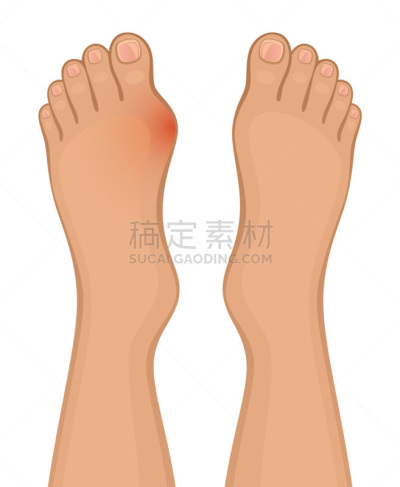 足,部分,背景分离,药,痛苦,白色,红色