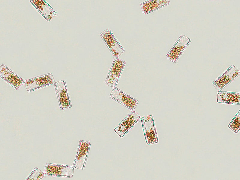 显微镜下的硅藻