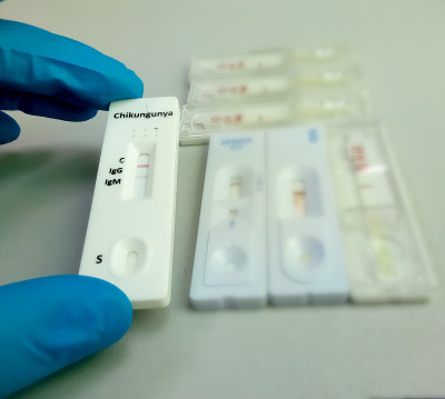 近距离观察技术人员或技术人员手持基孔肯雅病毒IgM快速筛查试剂盒，IgG结果呈阳性。
