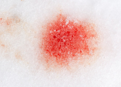 雪上有红色的血