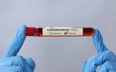 COVID-19血样管阳性