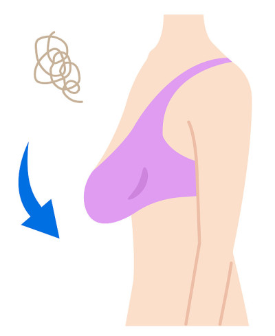 下垂的乳房的女人的身体插图。美体保健理念