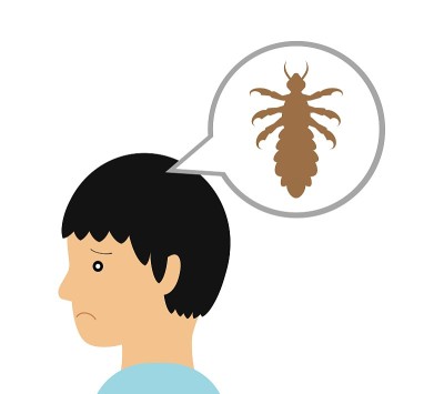 虱子
