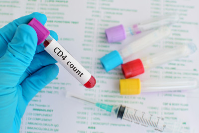 CD4细胞计数