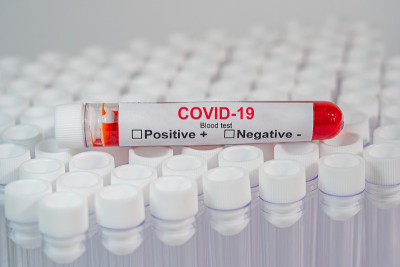 实验室COVID-19血液试管特写照片