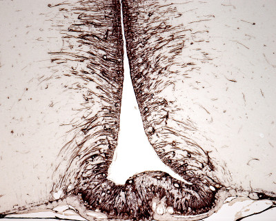 Tanycytes