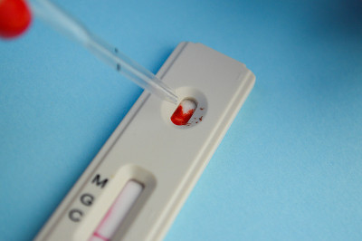在蓝色背景下进行冠状病毒检测。一个修了红色指甲的女孩做了血液测试。IgG、IgM抗体测定