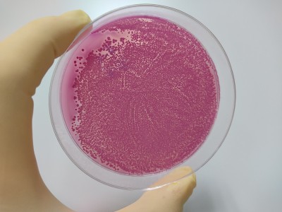 微生物培养结果观察