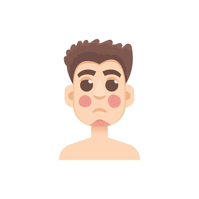银屑病或酒渣鼻男性面部。矢量插图。