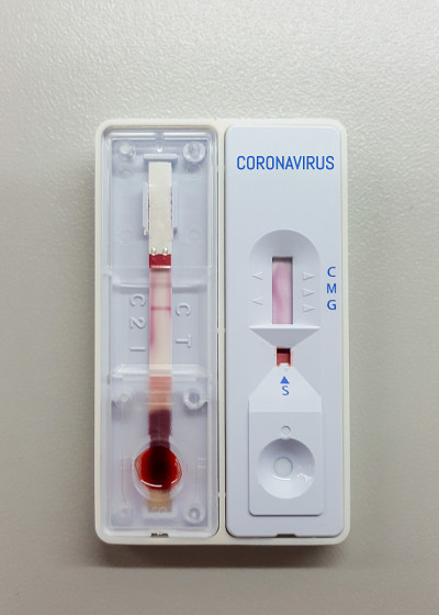 COVID-19或冠状病毒快速检测板。在大学研究实验室工作的科学家或实验室技术人员，在科学室检查医院