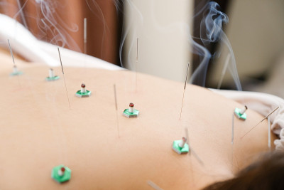 A woman with a needle stuck to her back at a brigh