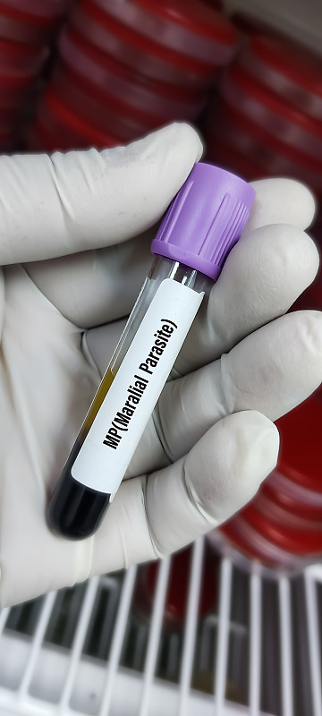 MP(疟疾寄生虫)血样管，全血EDTA真空管。
