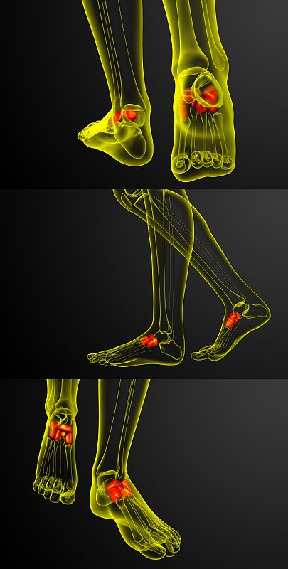3d渲染医学插图的中足骨