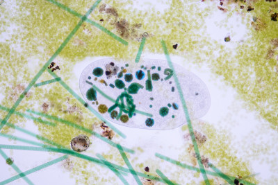 在显微镜下，Frontonia sp.是一种自由生活的单细胞纤毛虫原生生物。