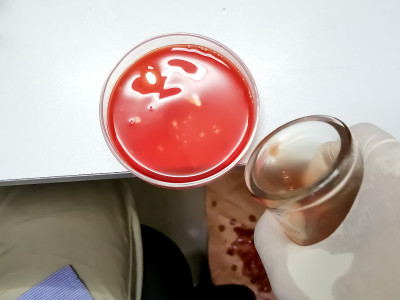 医学技术人员将羊血倒入培养皿中进行微生物培养。