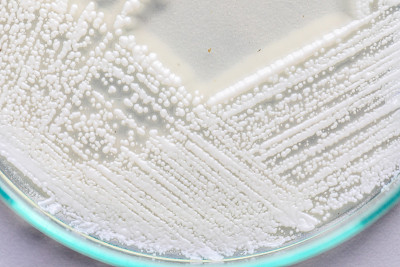 培养皿酵母菌，实验室微生物学教育。