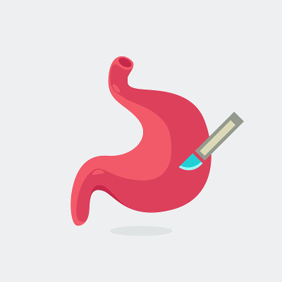 stomach-52