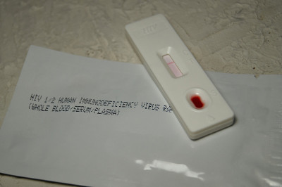 用一滴血进行HIV自检。艾滋病毒检测表达。