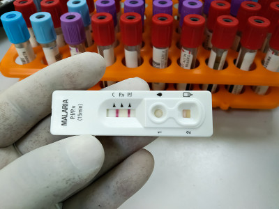 疟原虫间日疟原虫和恶性疟原虫试验盒。