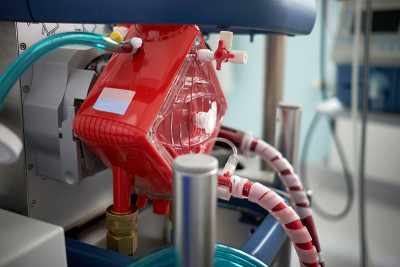 医学。体外膜肺氧合。在重症监护室使用ecmo。ECMO的特写氧合器。