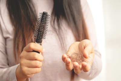 女性对洗发水过敏会导致脱发和头皮屑。