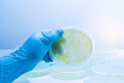 培养基板上蓝藻菌落，微生物学。