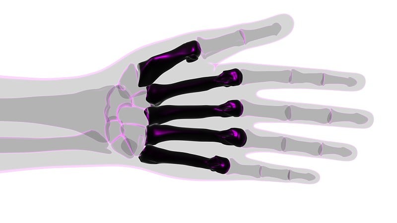 人体骨骼、手指骨、骨解剖学的医学概念