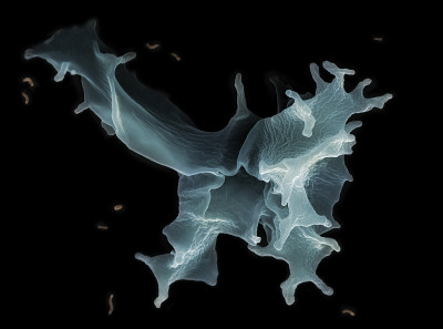 阿米巴(帕拉阿米巴perurans)， SEM